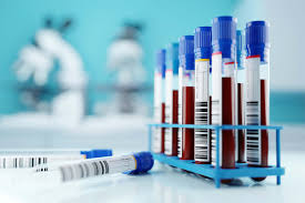 Blood Test & Lab Sample